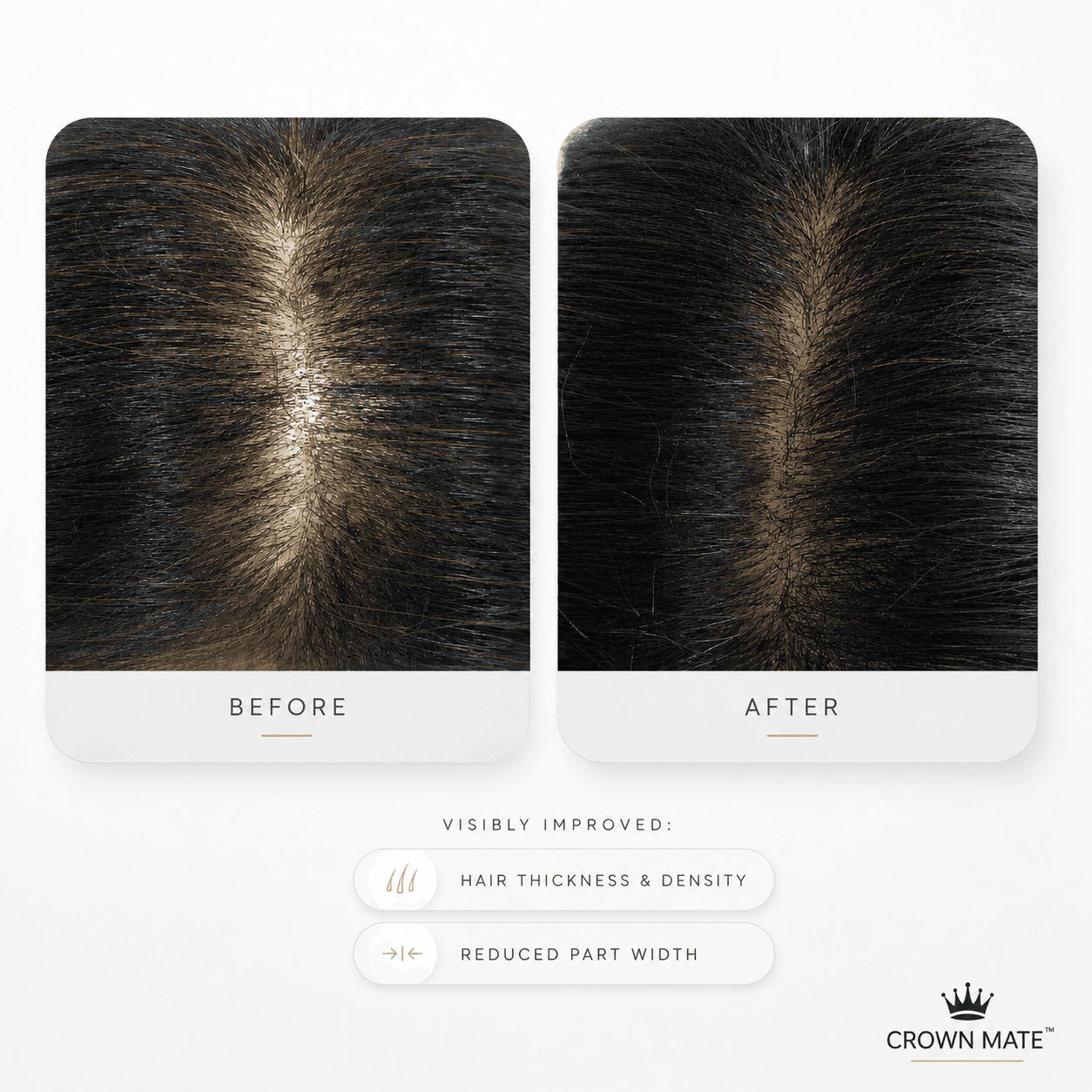 Crownmate High Frequency Wand™ — image 6